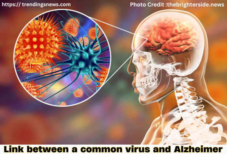 Surprising Connection Common Virus and Alzheimer's Disease Explained